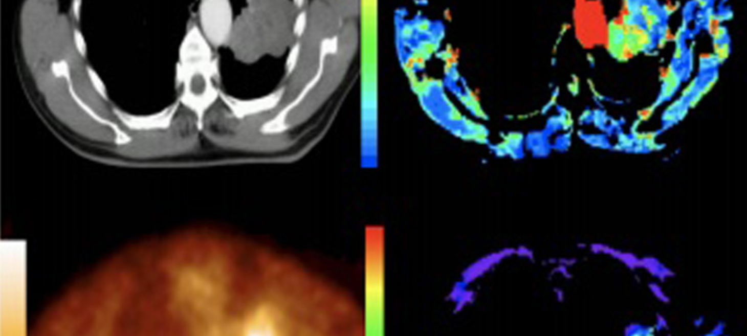 From Sussex Labs to Saving Lives: The Life-Changing Journey of TexRAD