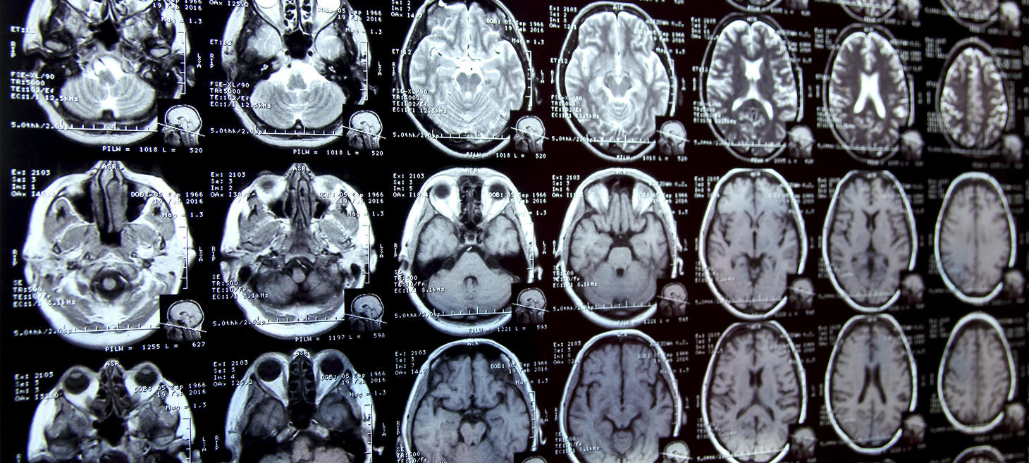 New AI system could accelerate clinical research | MIT News | Massachusetts Institute of Technology