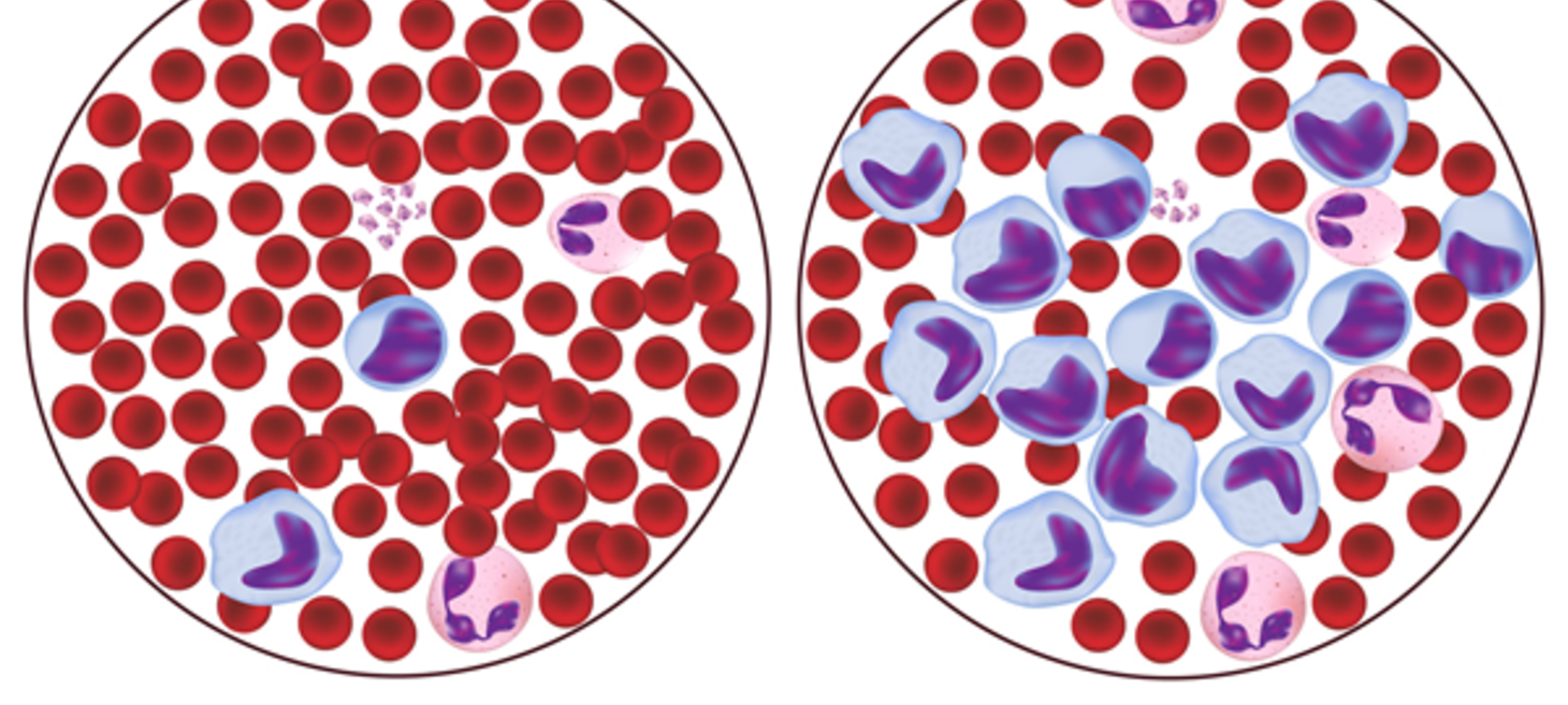 Classifying White Blood Cells with Convolutional Neural Networks