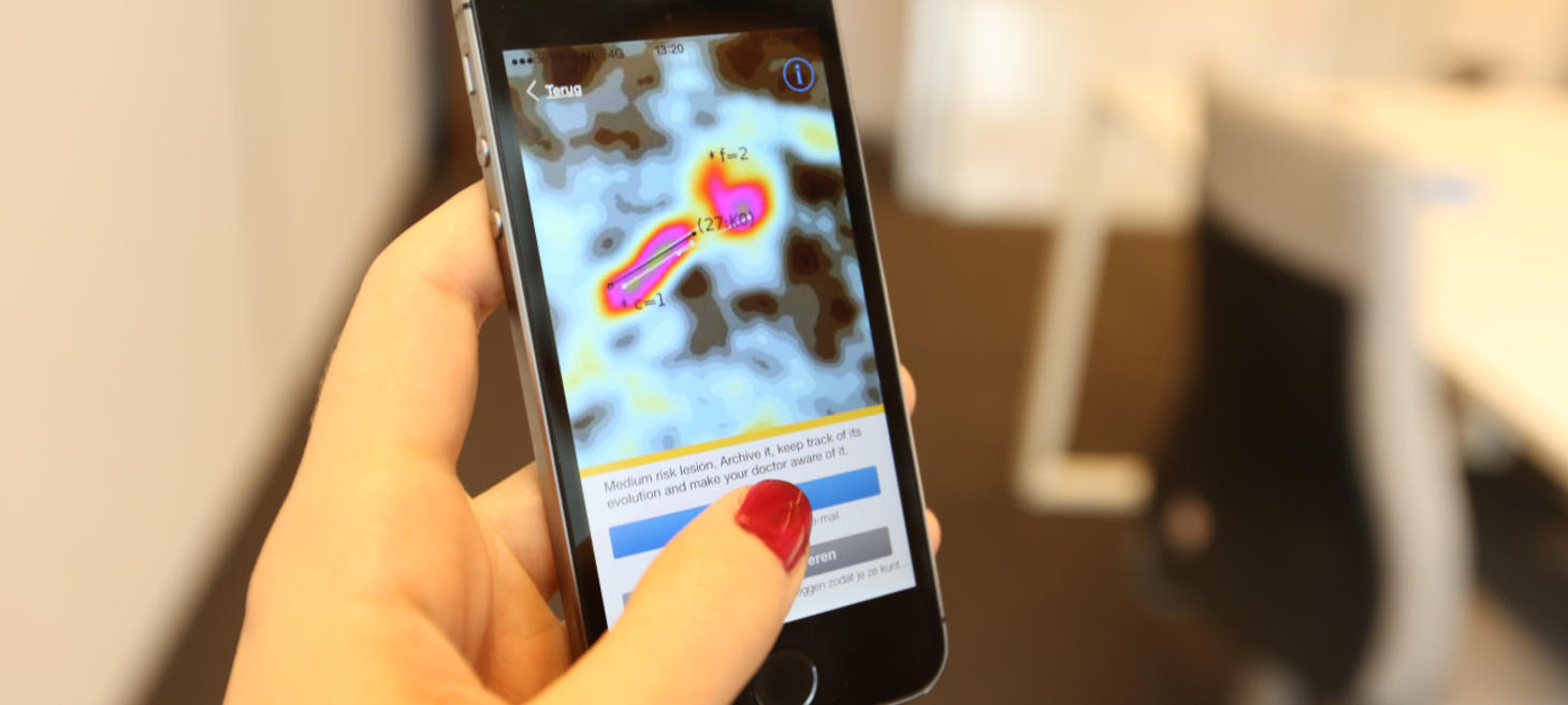 Dutch Skin Cancer Checker App, SkinVision, Snags $3.4M