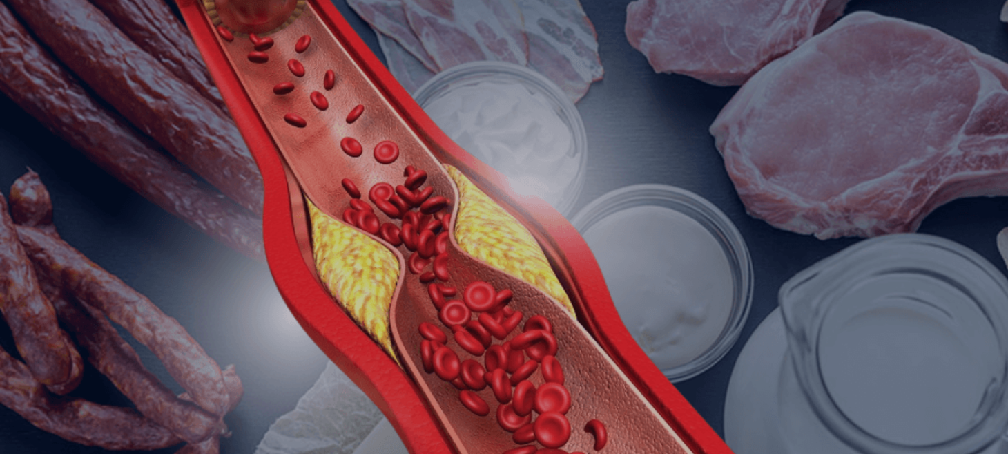 Does Increasing Saturated Fat in the Diet Increase LDL?